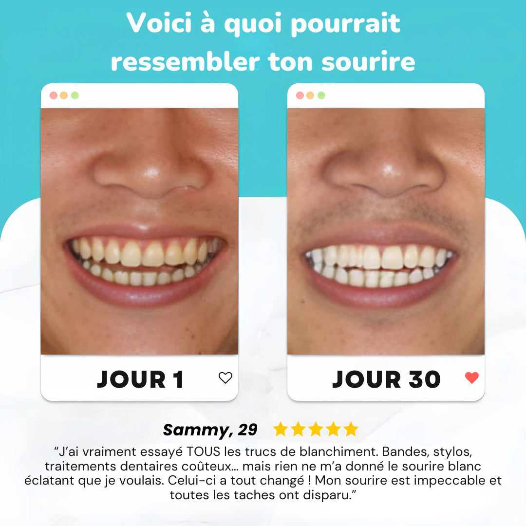MagicBrush™ Smile