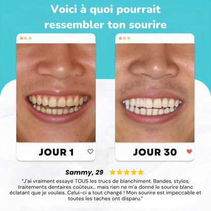 MagicBrush™ Smile